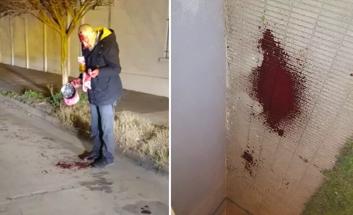 Tentativa de homicidio en ocasión de robo