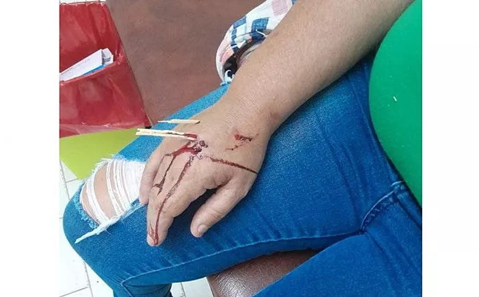 Herida